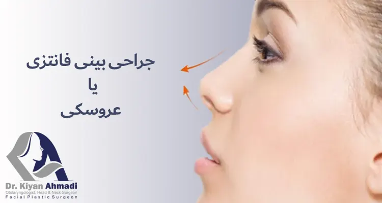 عمل جراحی بینی فانتزی