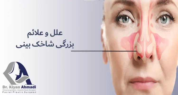 بزرگی شاخک بینی - دکتر کیان احمدی