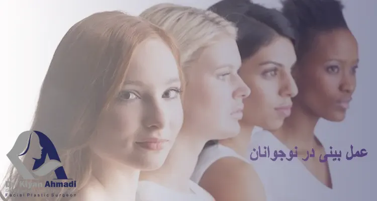 عمل بینی در نوجوانی