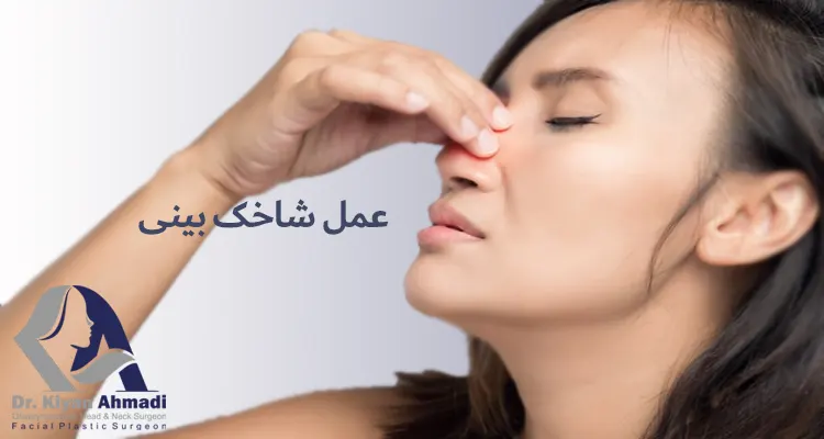 بزرگی شاخک بینی - دکتر کیان احمدی