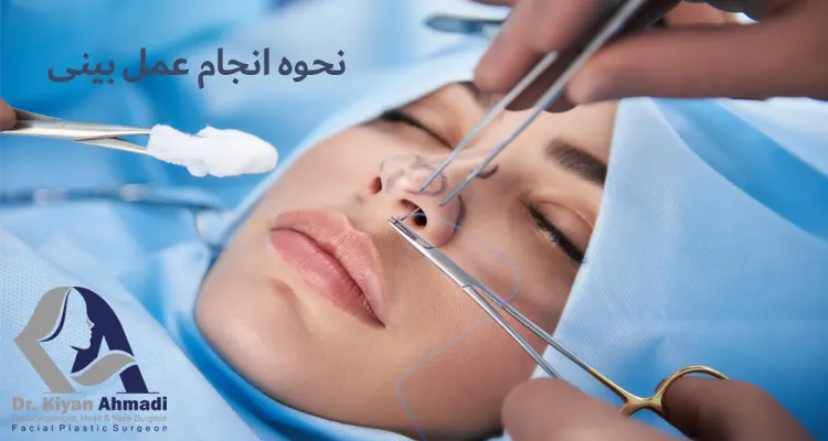 نحوه انجام عمل بینی