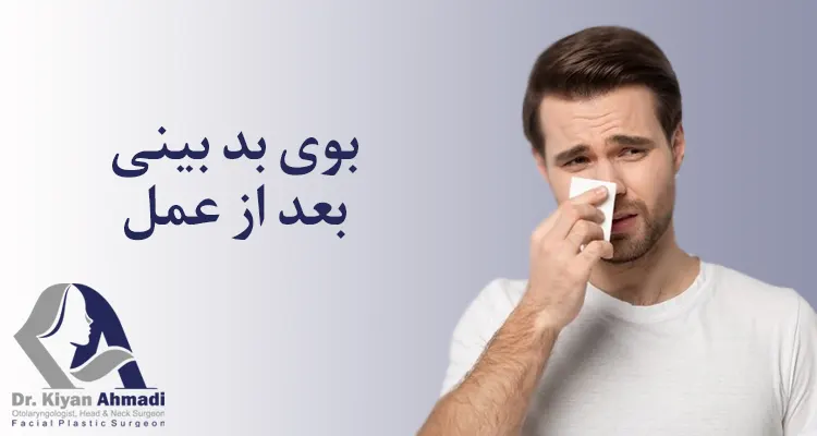 بوی بد بینی بعد از رینوپلاستی