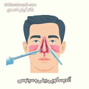 آندوسکوپی بینی - دکتر کیان احمدی