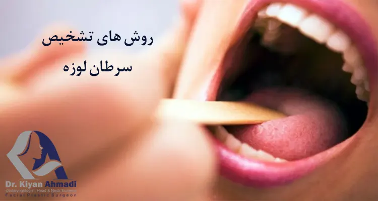 سرطان لوزه و تشخیص آن