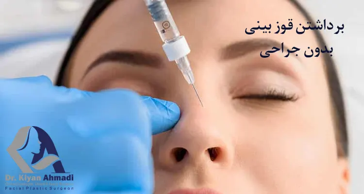 برداشتن قوز بینی بدون جراحی