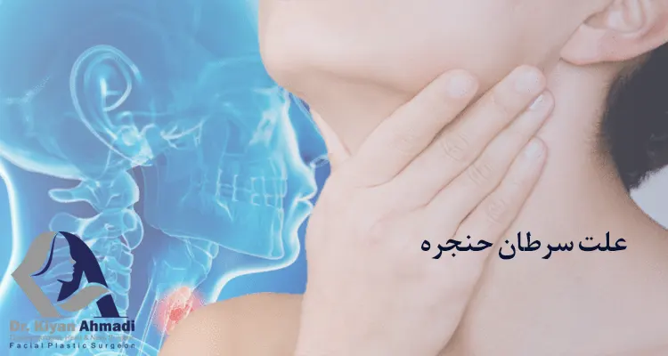 دلایل سرطان حنجره