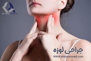 جراحی لوزه در بروجرد - دکتر کیان احمدی