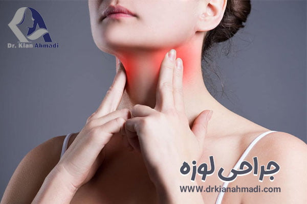 جراحی لوزه در بروجرد - دکتر کیان احمدی