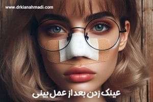 عینک زدن بعد از عمل بینی + دکتر کیان احمدی