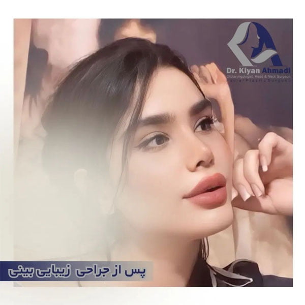 بهترین جراح بینی بروجرد - دکتر کیان احمدی