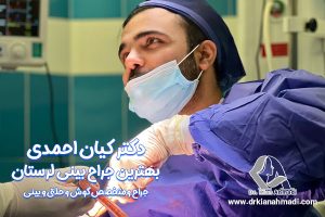 جراح بینی لرستان - دکتر کیان احمدی