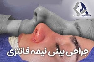 عمل بینی نیمه فانتزی در بروجرد + دکتر کیان احمدی