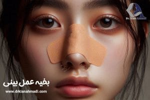 بخیه عمل بینی - دکتر کیان احمدی