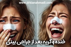 خنده و گریه بعد از جراحی بینی + دکتر کیان احمدی