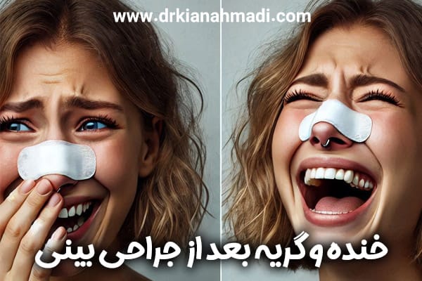 خنده و گریه بعد از جراحی بینی + دکتر کیان احمدی