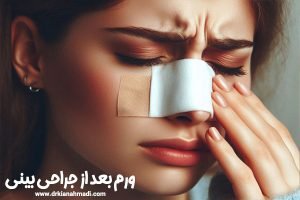 ورم بعد از جراحی بینی - دکتر کیان احمدی