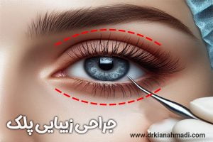 جراحی پلک در بروجرد - دکتر کیان احمدی