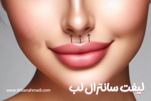 جراحی لیفت سانترال لب - دکتر کیان احمدی