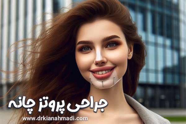 پروتز چانه در بروجرد - دکتر کیان احمدی 