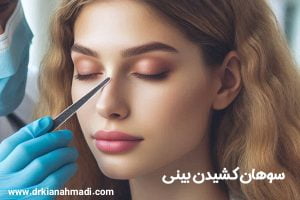 سوهان کشیدن بینی - دکتر کیان احمدی