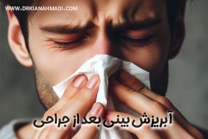 آبریزش بینی بعد از جراحی - دکتر کیان احمدی