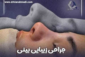 جراحی بینی در بروجرد - دکتر کیان احمدی