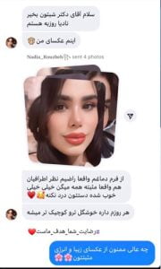 بهترین جراح بینی در بروجرد - دکتر کیان احمدی