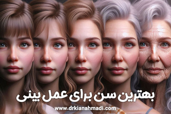 بهترین سن برای عمل بینی + دکتر کیان احمدی